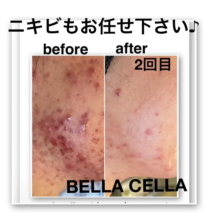 脱毛サロン mamanaの掲載