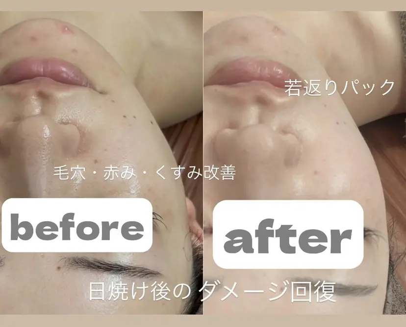 浮腫|肩こり|張り 日々の疲れを解消★の掲載