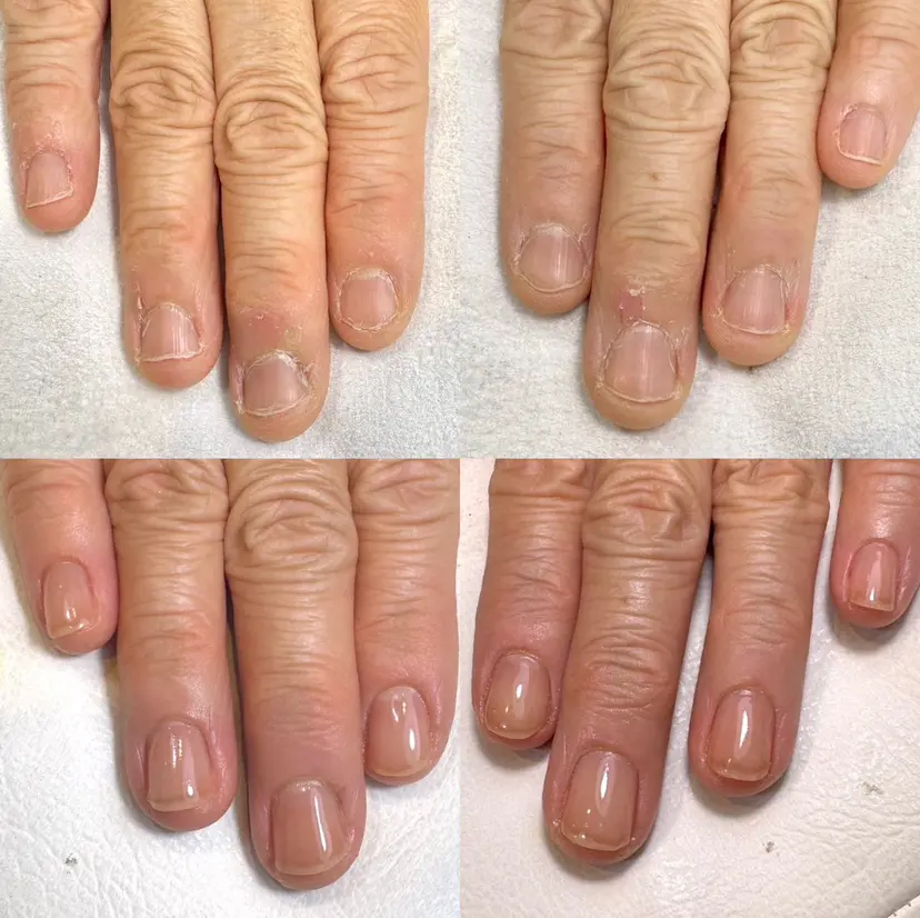 hau nailの掲載