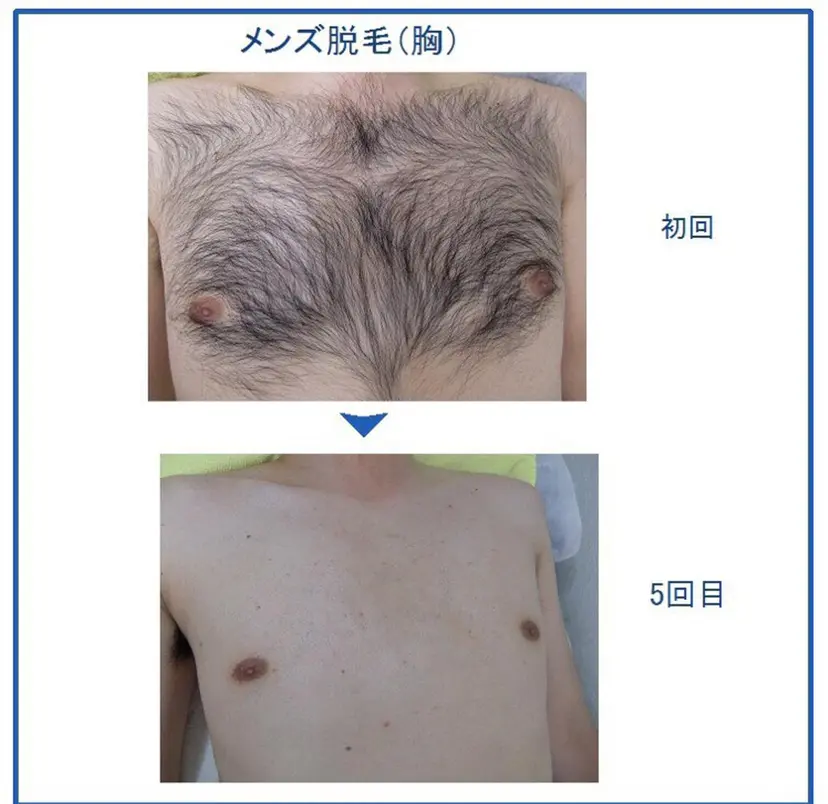 kato fの掲載