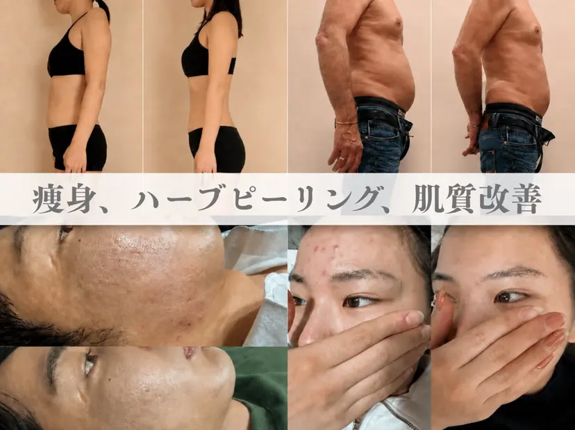 ピーリング.痩身 SLIMOREの掲載
