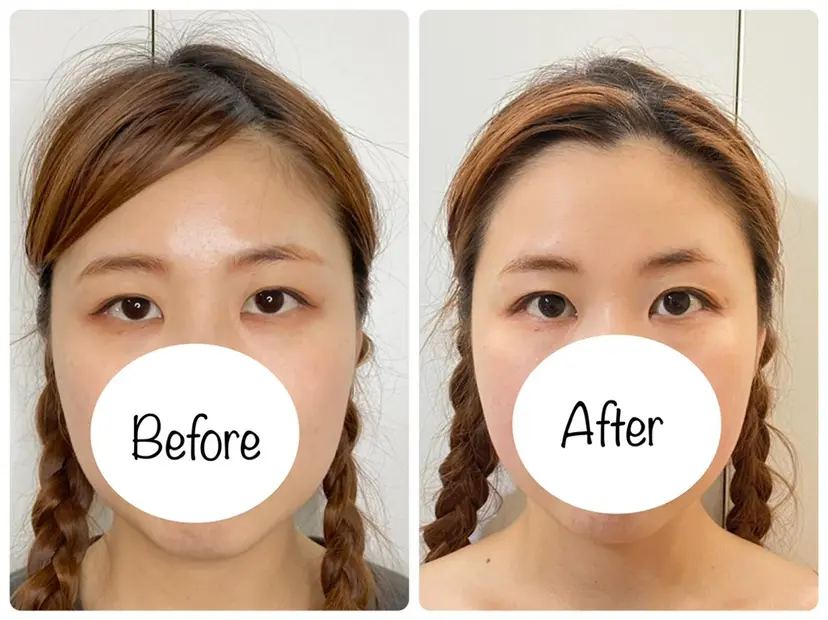 小顔トータルサロン Unicaの掲載