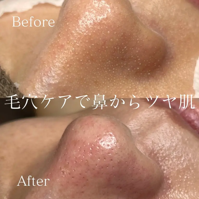 chi kaの掲載