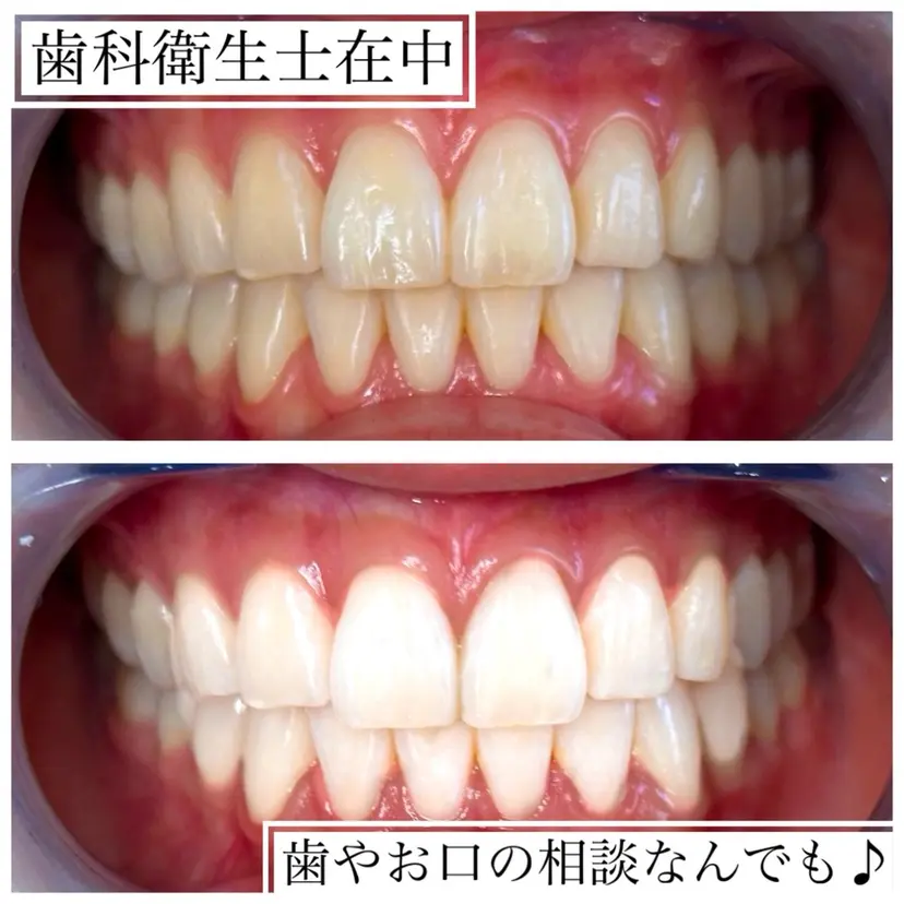 White base ホワイトニングサロンの掲載