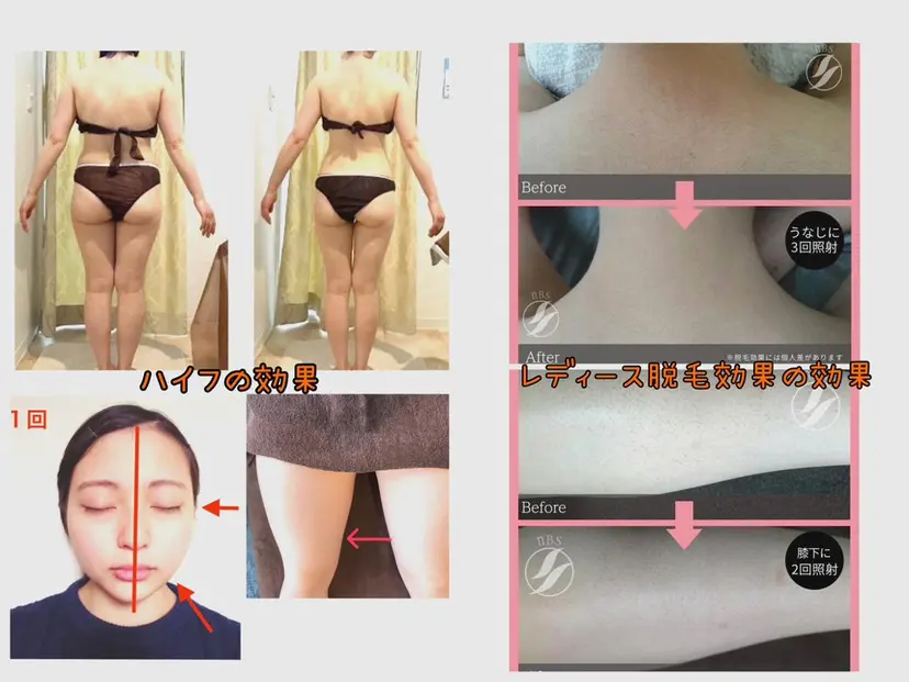 痩身・脱毛・美髪ケア 【GLYCINE】の掲載