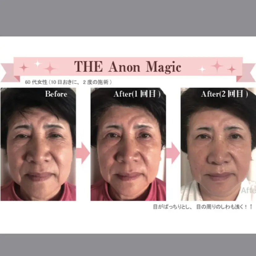 トータルビューティー Aqureの掲載