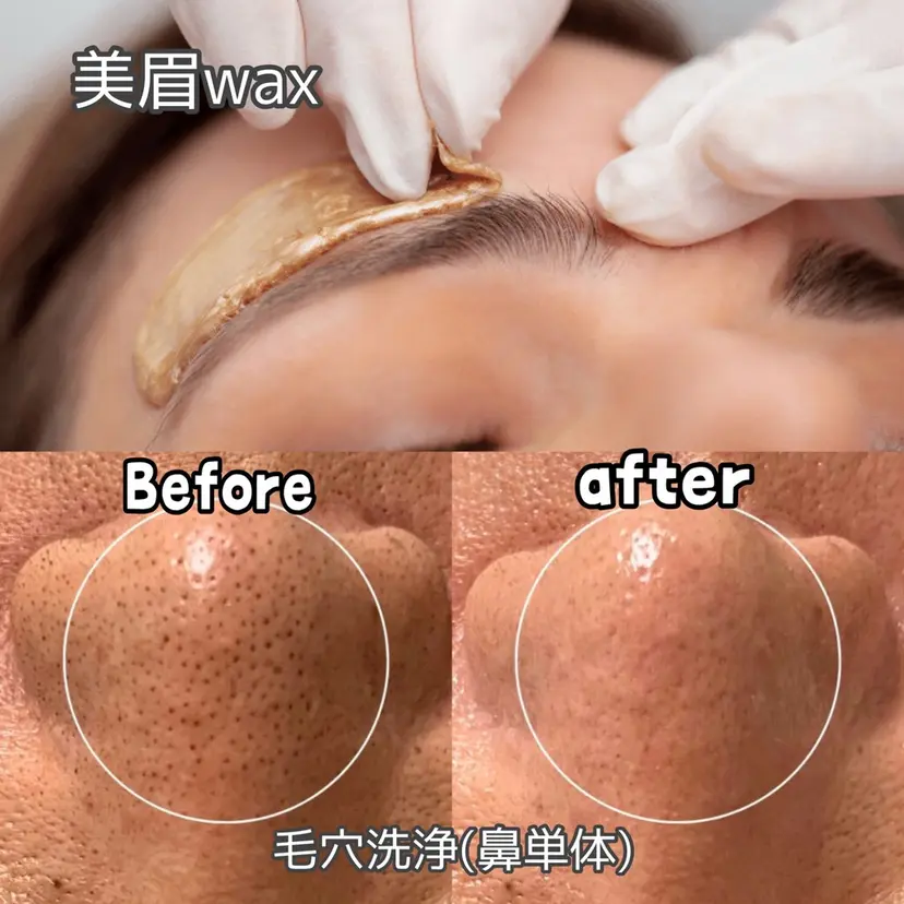 Anuenue 眉毛専用、毛穴洗浄の掲載