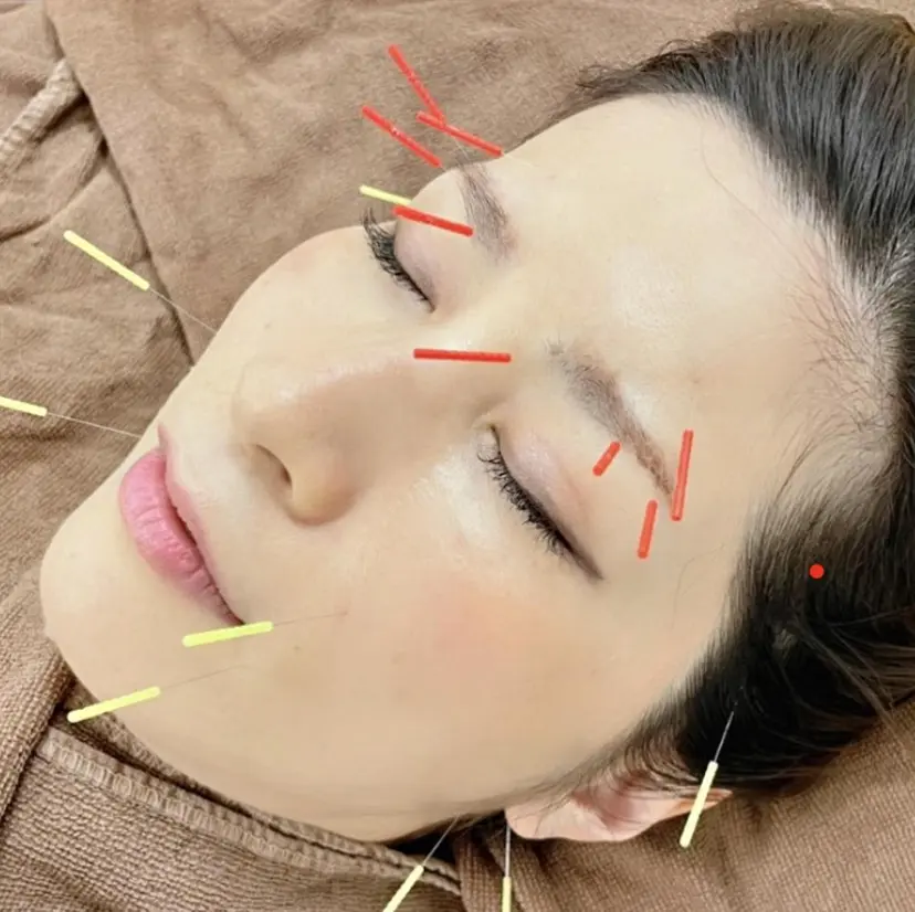 水島 秀輝（美容鍼灸師）の掲載