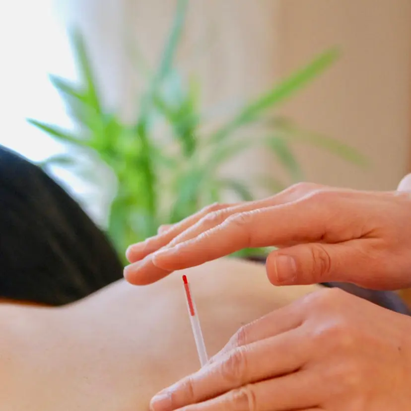 はりきゅう百会 💐美容鍼💐の掲載