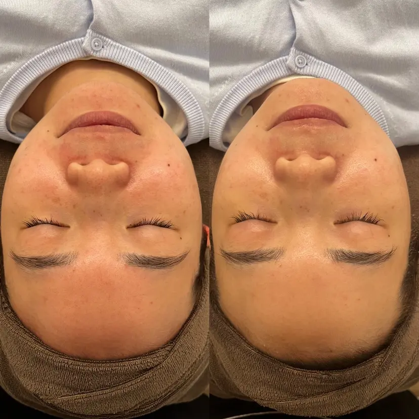 Dioe 自由が丘の掲載