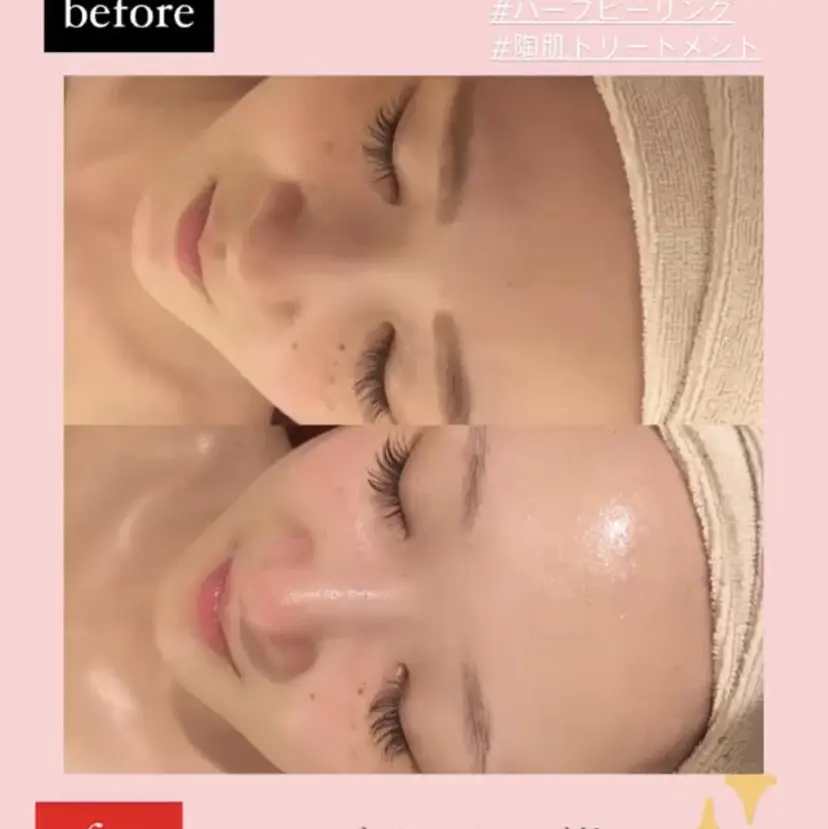 よもぎ蒸し サロンの掲載