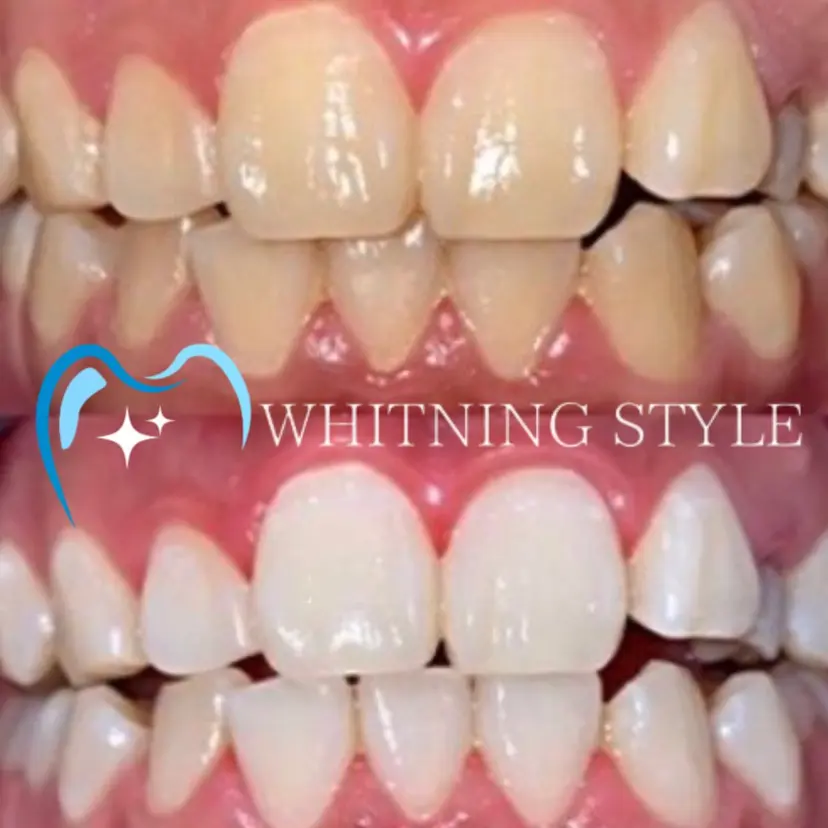 【歯科提携】柏ホワイ トニングスタイルの掲載