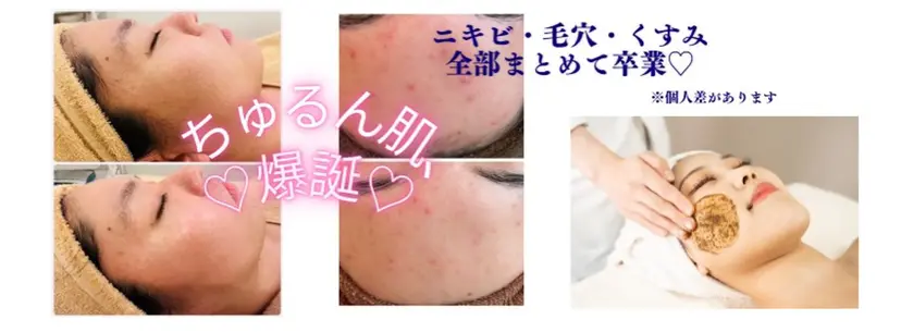 ハーブピーリング専門 店Oneの掲載