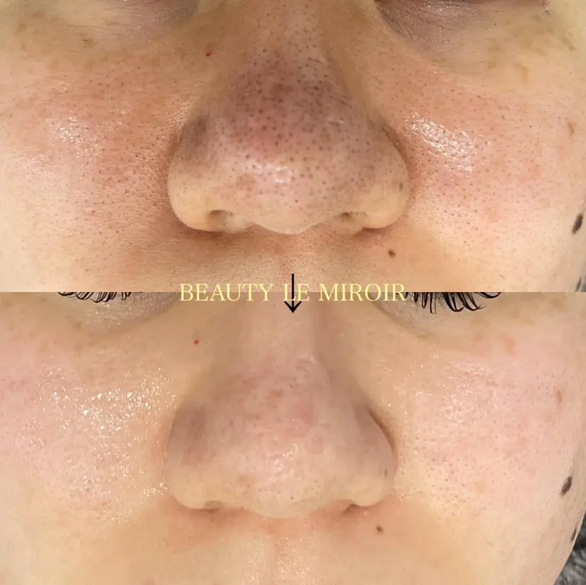 ビューティー ミロワールの掲載