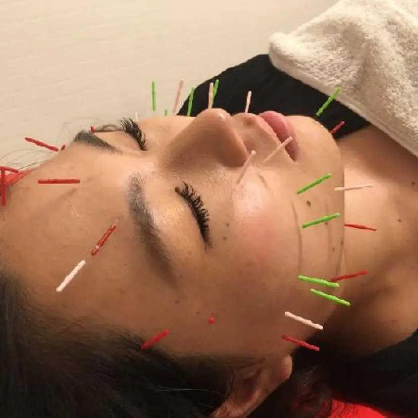 🌈 肌質改善 🙌 美容鍼 ヒロキ🌈の掲載