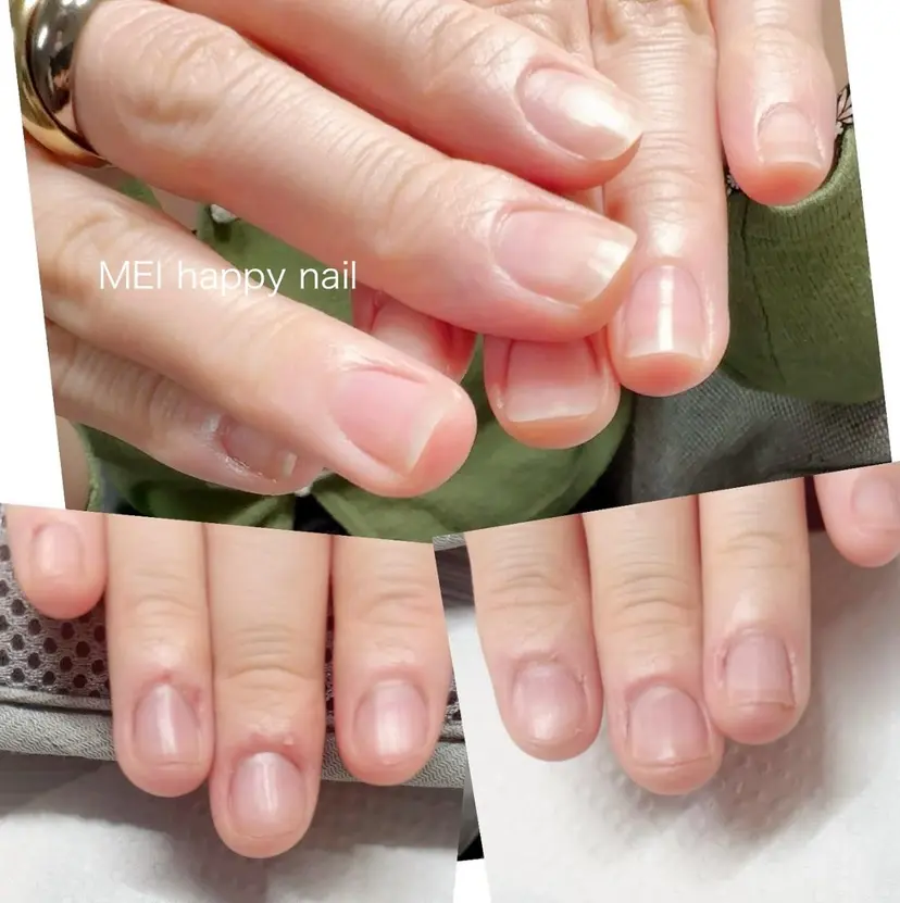 北浦和 自爪育成ケアの掲載