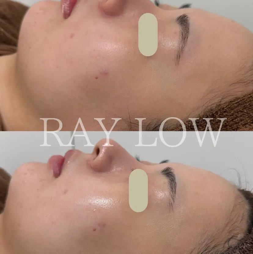 RAY LOW レイロウの掲載