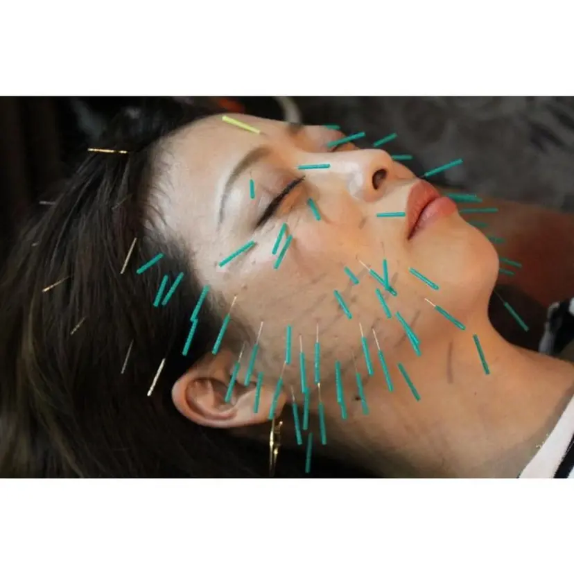 美容鍼灸イロドリ  の掲載