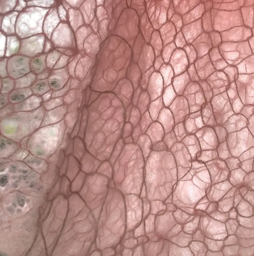 ☂️chihiro 🌂の掲載