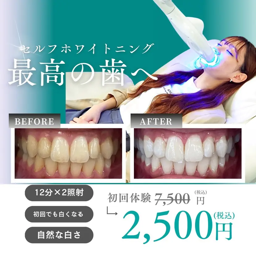 ホワイトニングサロン CREWの掲載