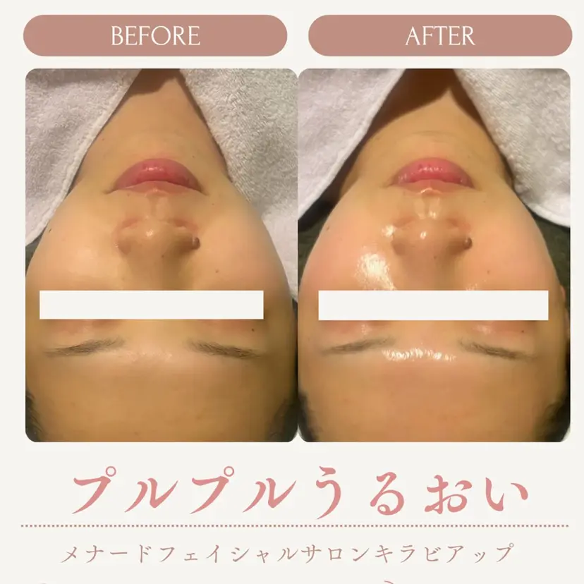 肌改善・美肌サポート 🤍tokoの掲載