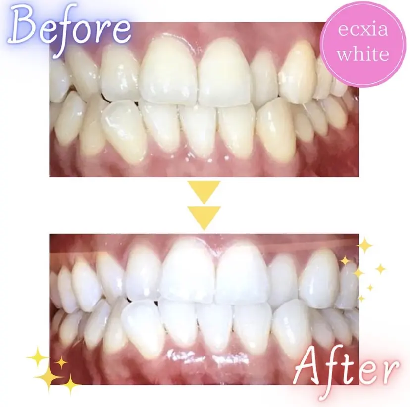 山本 佳那の掲載