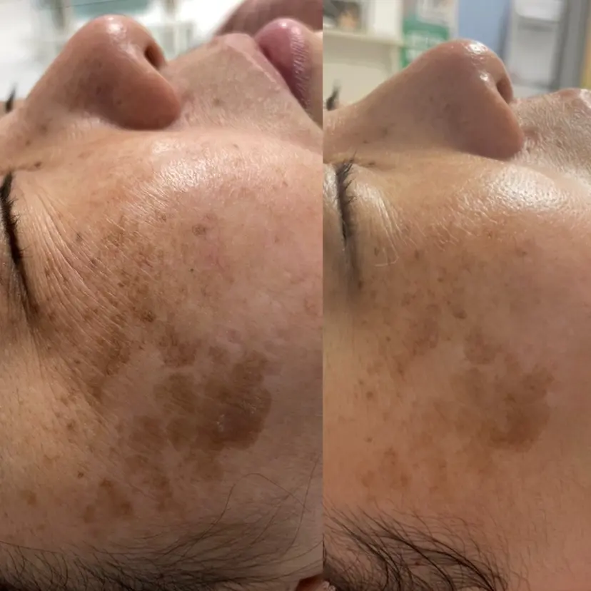 柴田 千恵の掲載