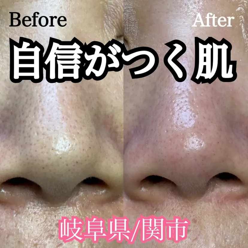 小林 菜月の掲載