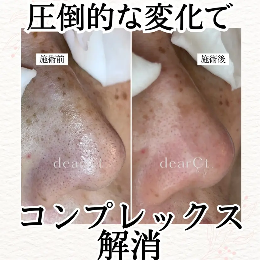 毛穴専門店 ディアカラットの掲載