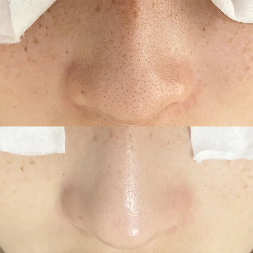 セラピスト MIKIの掲載