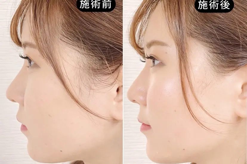 渋谷 小顔美容鍼 専門サロン YZの掲載