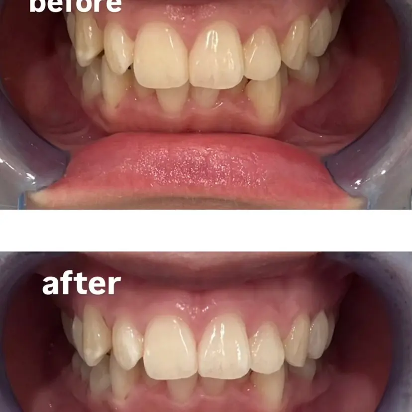 ホワイトニングサロン スズキ　　ミアキの掲載