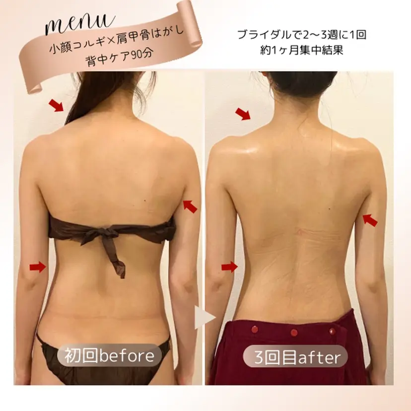 肌質改善×小顔サロン リトリト垣内の掲載