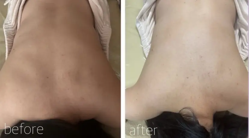 エステティックサロン 向日葵三宮店の掲載