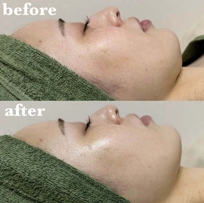 肌質改善＆脱毛 【M Mondo】の掲載