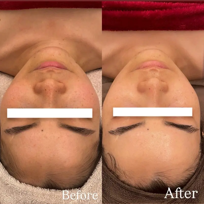 Dioe 自由が丘の掲載