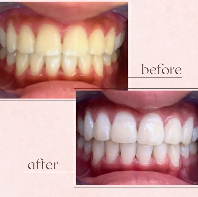 橋口 花菜子の掲載