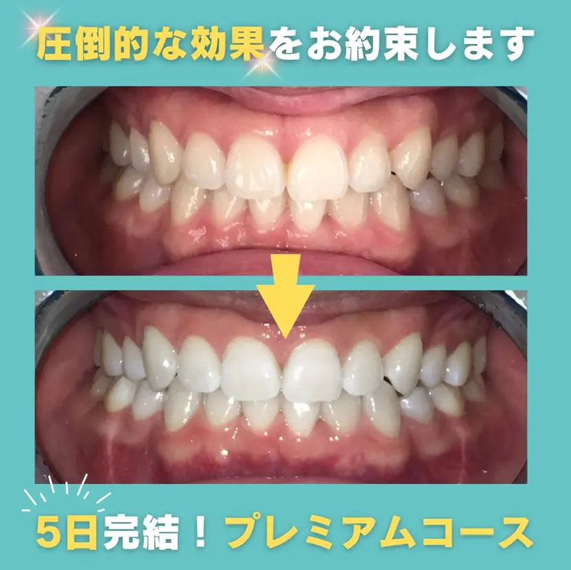 nomama ホワイトニング大宮店の掲載