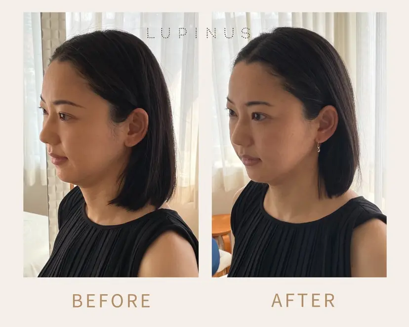 美容整体ルピナス 及川ゆりかの掲載