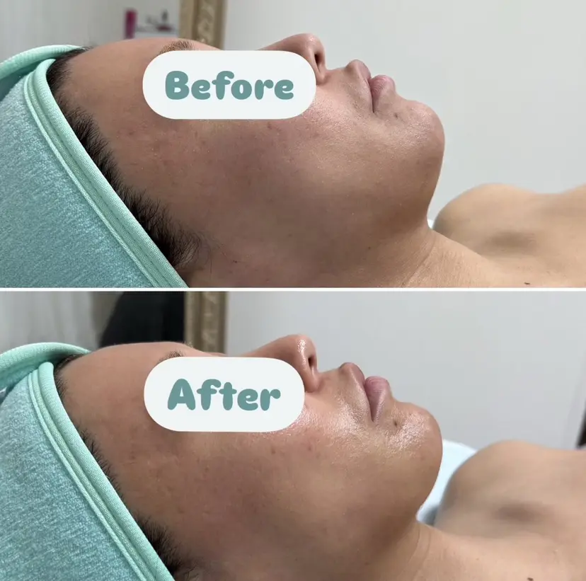 菊原 令奈の掲載