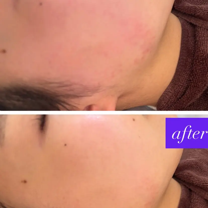 【Resetlab】 Chihiroの掲載