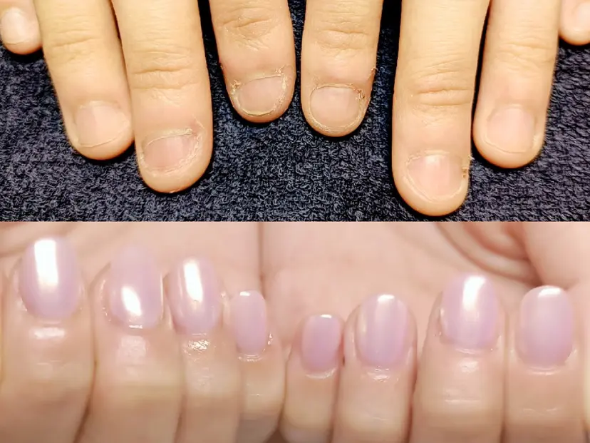 深爪矯正/爪育成ケア manie nailの掲載