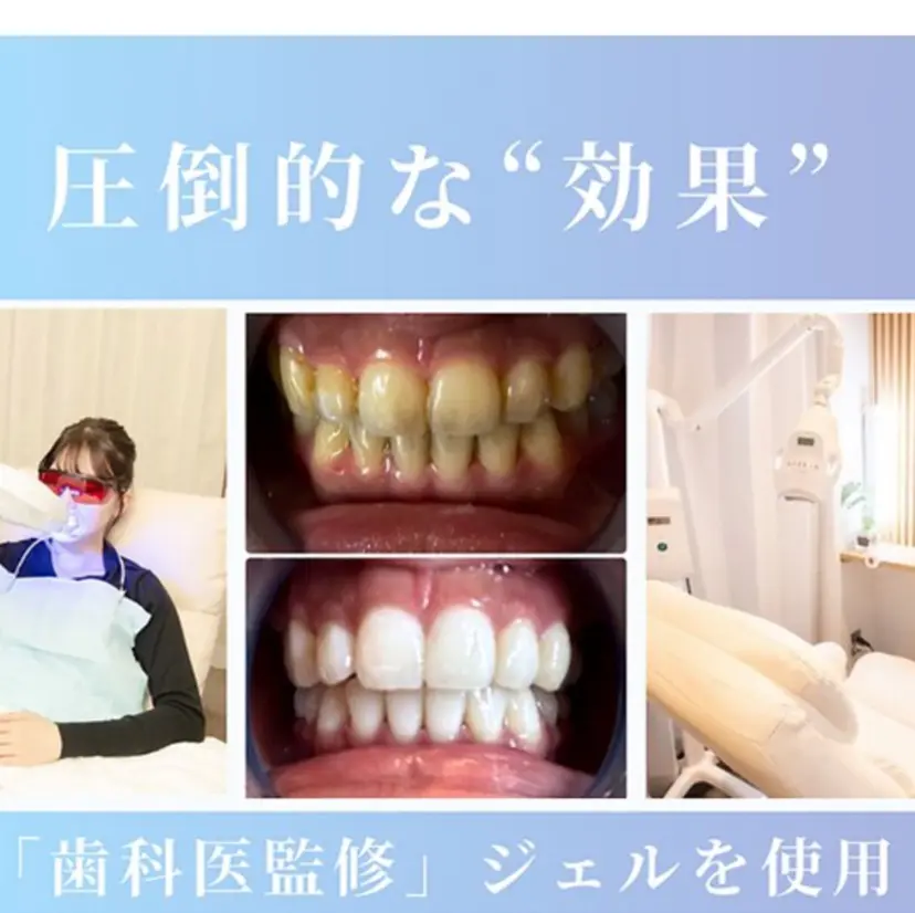 NAホワイトニング /自由が丘の掲載