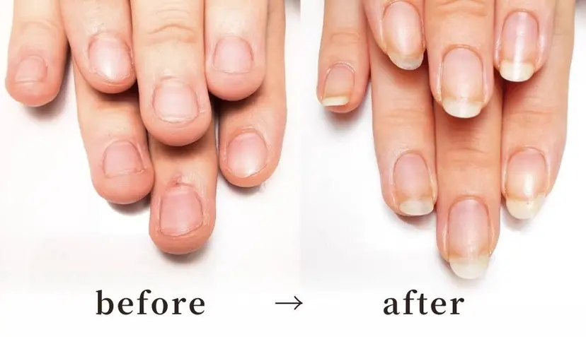 天王寺 深爪メディカルサロンの掲載