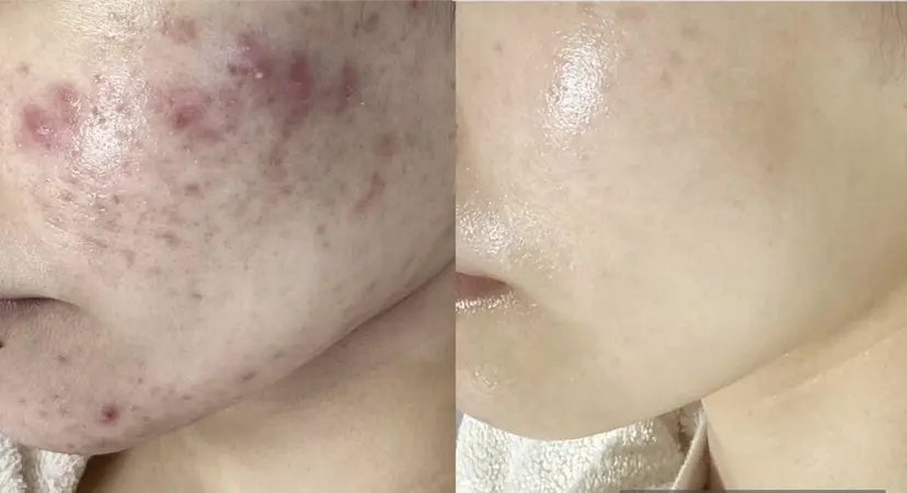 都度払い 肌質改善専門サロンの掲載