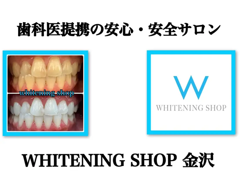 ホワイトニング ショップ金沢の掲載