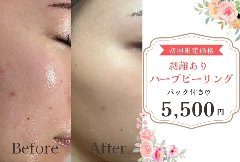 プライベートサロン Belle(ベル)の掲載