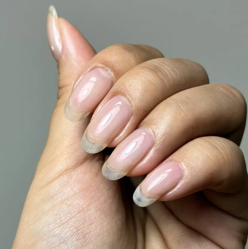 広島市南区(広島県) /深爪/自爪育成の掲載