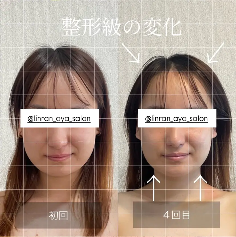 小顔集中型エステ 堺／大美野の掲載