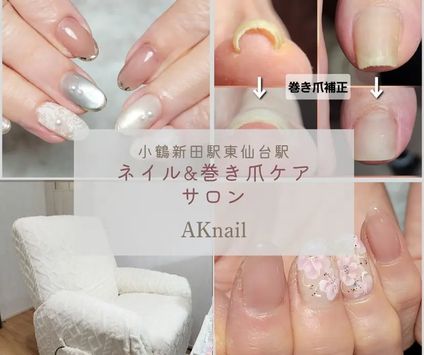 ネイル&巻き爪サロン 　AKnailの掲載